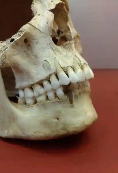 Skull from the 3rd Century